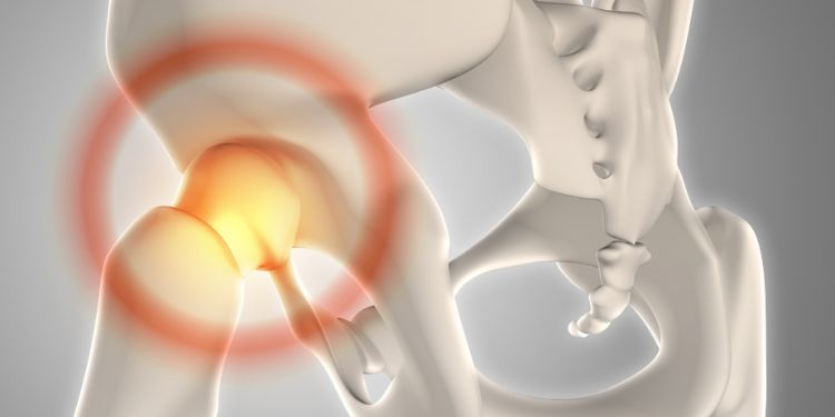 Article: Secondary Hip Fractures among Aging Adults with a Previous Hip Fracture History: Cumulative 50 Year Overview, Analysis, and Possible Antidote as Observed from 1974-2026 Data Sources